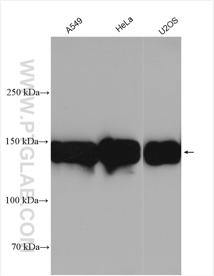 Western Blot (WB) analysis of various lysates using Integrin Alpha 5 Polyclonal antibody (27224-1-AP)