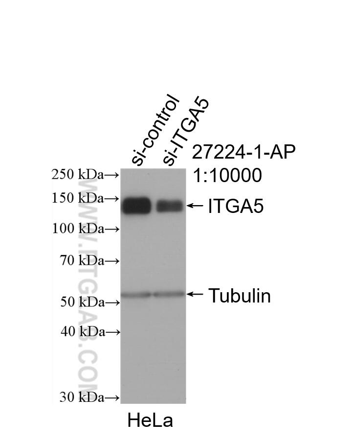 Western Blot (WB) analysis of HeLa cells using Integrin Alpha 5 Polyclonal antibody (27224-1-AP)
