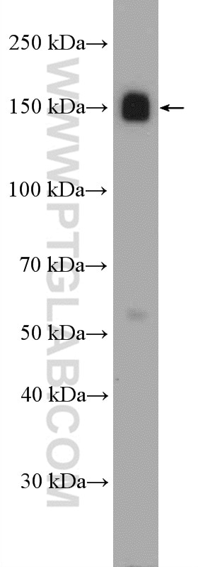 Western Blot (WB) analysis of HeLa cells using Integrin Alpha 5 Polyclonal antibody (27224-1-AP)