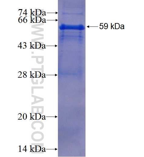 Integrin alpha-5 fusion protein Ag0860 SDS-PAGE