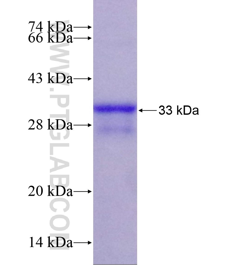 Integrin alpha-6 fusion protein Ag17991 SDS-PAGE