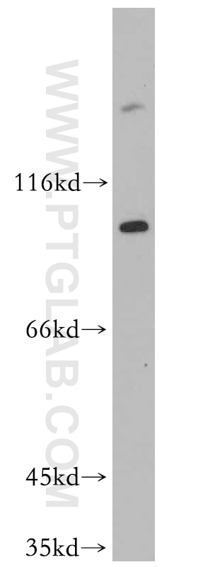 Western Blot (WB) analysis of mouse colon tissue using ITGA6X1A Polyclonal antibody (20231-1-AP)