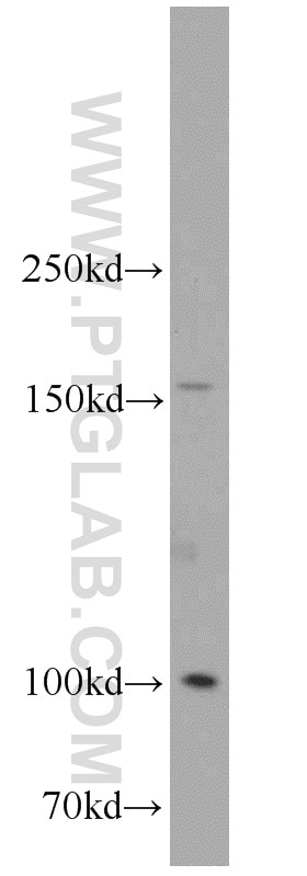 Western Blot (WB) analysis of mouse spleen tissue using ITGA6X1A Polyclonal antibody (20231-1-AP)