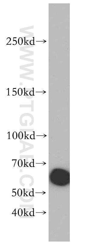 WB analysis of mouse heart using 20232-1-AP