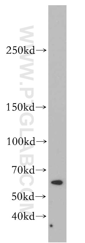 Western Blot (WB) analysis of mouse kidney tissue using ITGA6X1B Polyclonal antibody (20232-1-AP)