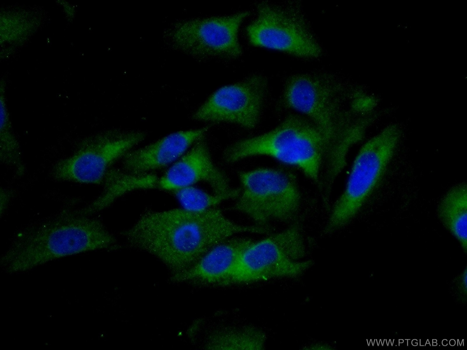 Immunofluorescence (IF) / fluorescent staining of A549 cells using Integrin Alpha 9 Polyclonal antibody (14593-1-AP)