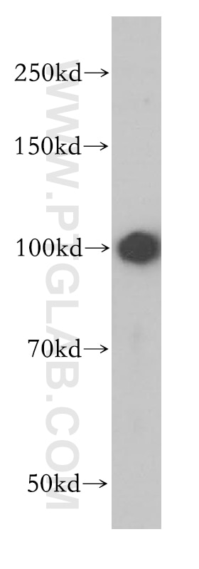 Western Blot (WB) analysis of human liver tissue using Integrin Alpha 9 Polyclonal antibody (14593-1-AP)