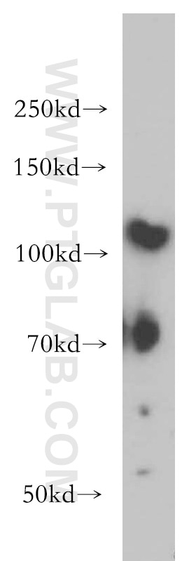 Western Blot (WB) analysis of A549 cells using Integrin Alpha 9 Polyclonal antibody (14593-1-AP)