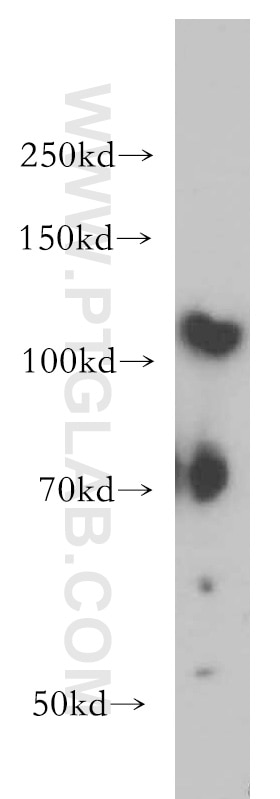 WB analysis of A549 using 14593-1-AP