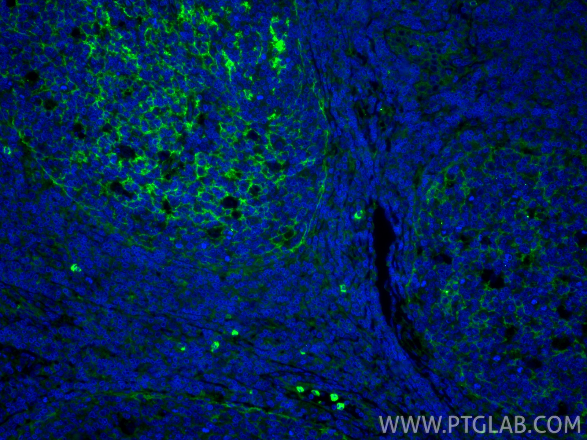 Immunofluorescence (IF) / fluorescent staining of human tonsillitis tissue using CD11b Polyclonal antibody (21851-1-AP)