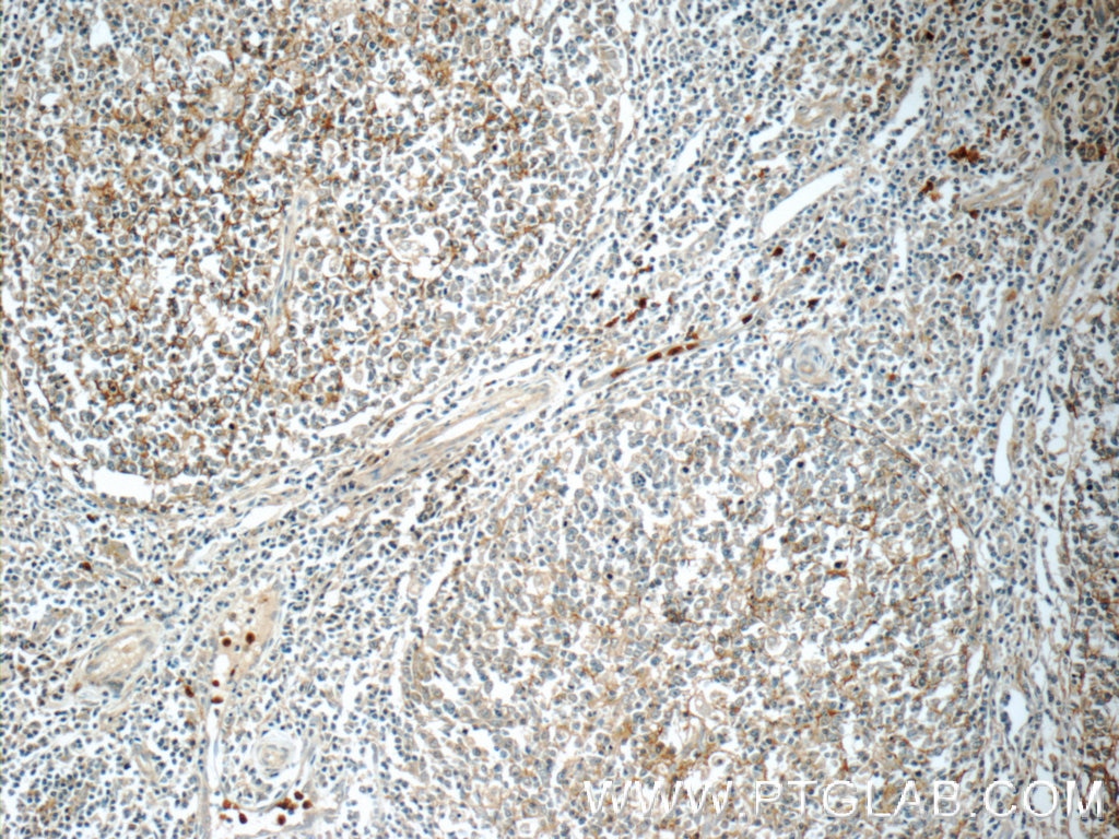 CD11B/Integrin Alpha M