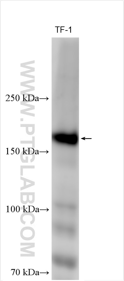 Western Blot (WB) analysis of various lysates using CD11B/Integrin Alpha M Polyclonal antibody (21851-1-AP)
