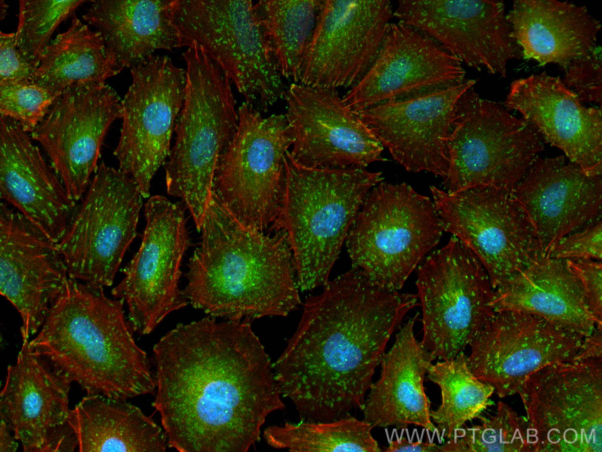 Immunofluorescence (IF) / fluorescent staining of A549 cells using Integrin Alpha V Polyclonal antibody (27096-1-AP)