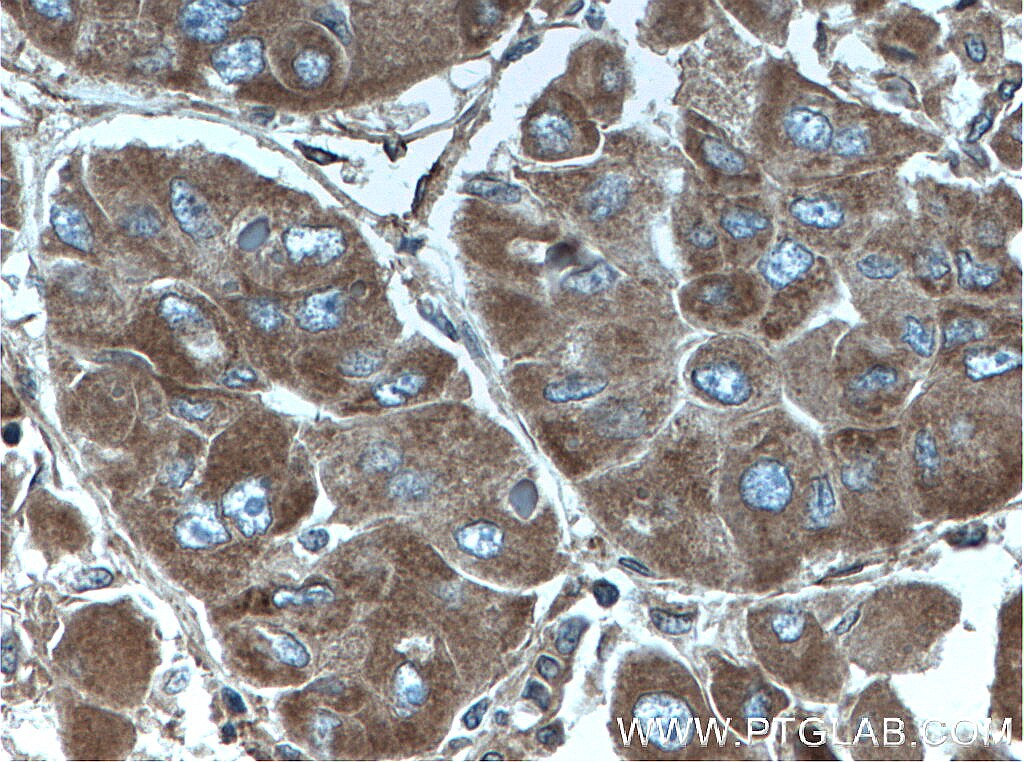 Integrin Alpha V