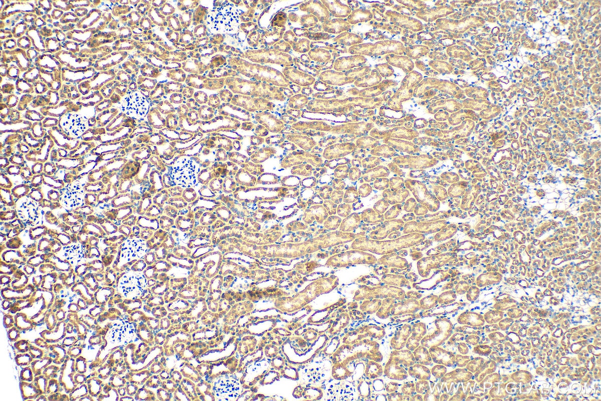 Immunohistochemistry (IHC) staining of mouse kidney tissue using Integrin Alpha V Polyclonal antibody (27096-1-AP)