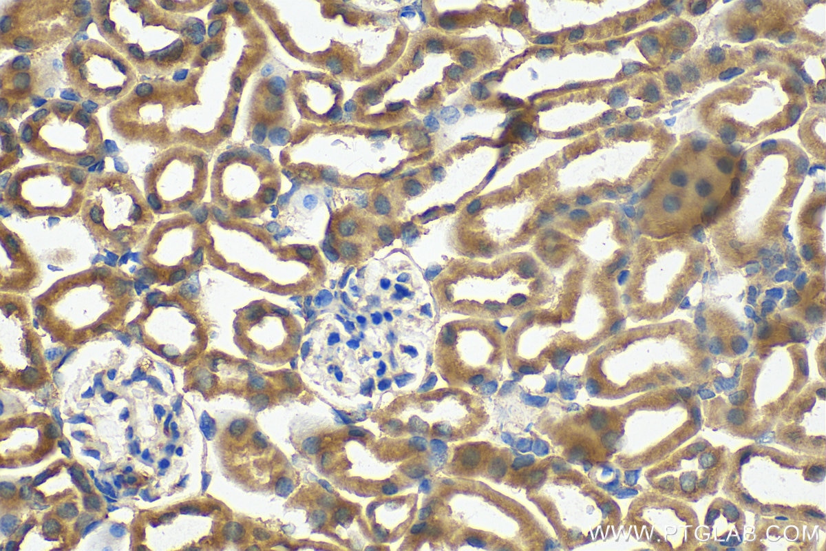 Immunohistochemistry (IHC) staining of mouse kidney tissue using Integrin Alpha V Polyclonal antibody (27096-1-AP)