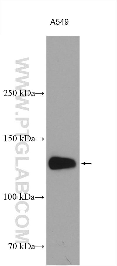 Western Blot (WB) analysis of various lysates using Integrin Alpha V Polyclonal antibody (27096-1-AP)