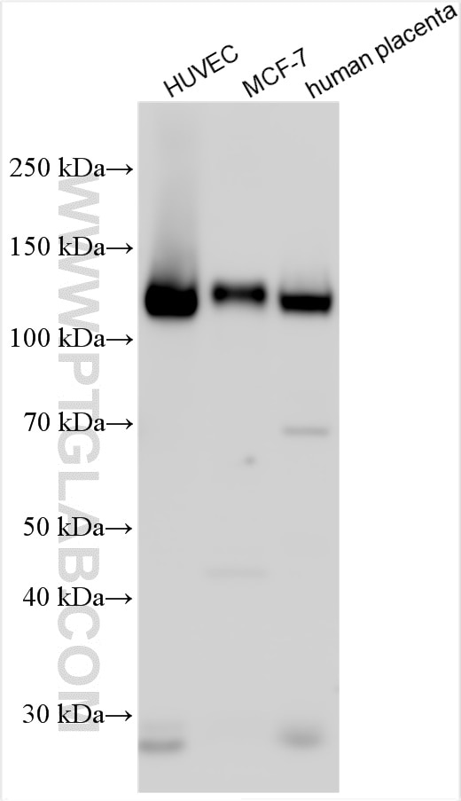 Western Blot (WB) analysis of various lysates using Integrin Alpha V Polyclonal antibody (27096-1-AP)