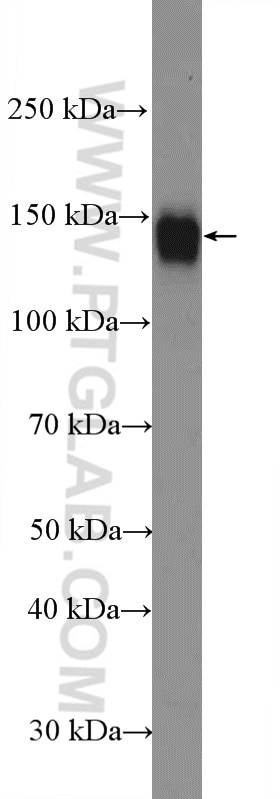 Western Blot (WB) analysis of HUVEC cells using Integrin Alpha V Polyclonal antibody (27096-1-AP)