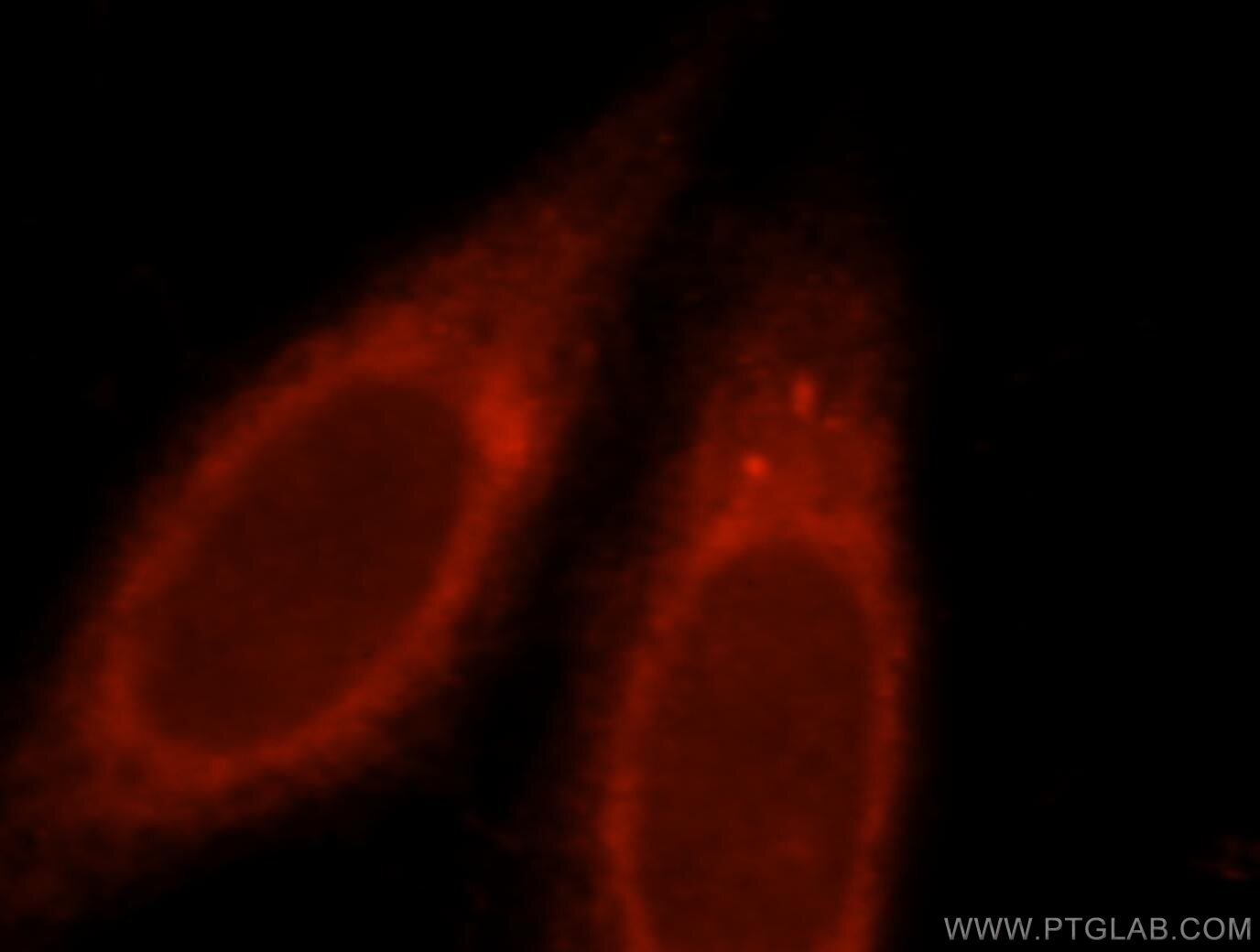 CD11c/Integrin Alpha X