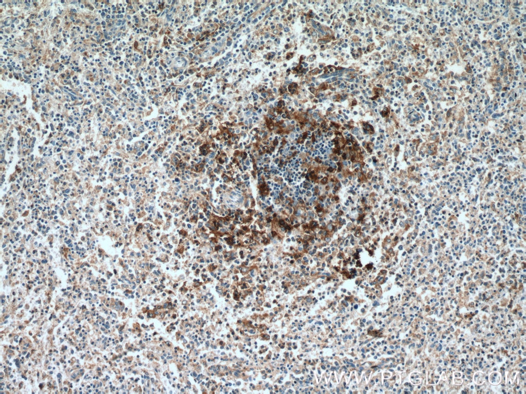Immunohistochemistry (IHC) staining of human spleen tissue using CD11c/Integrin Alpha X Polyclonal antibody (17342-1-AP)