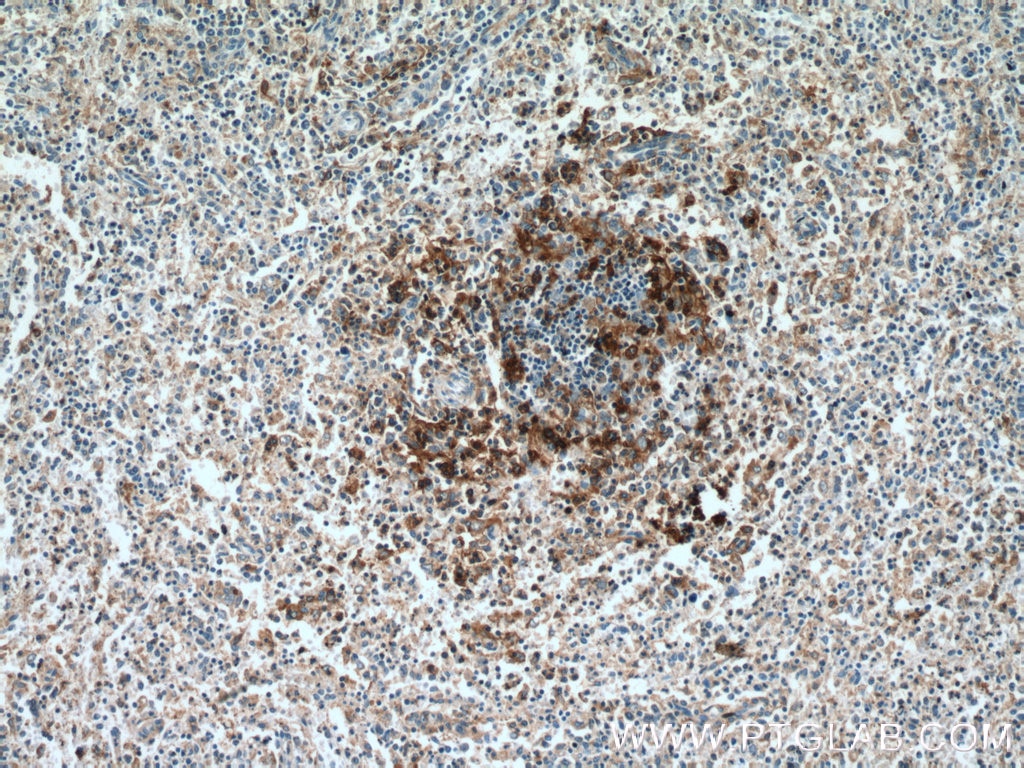 IHC staining of human spleen using 17342-1-AP