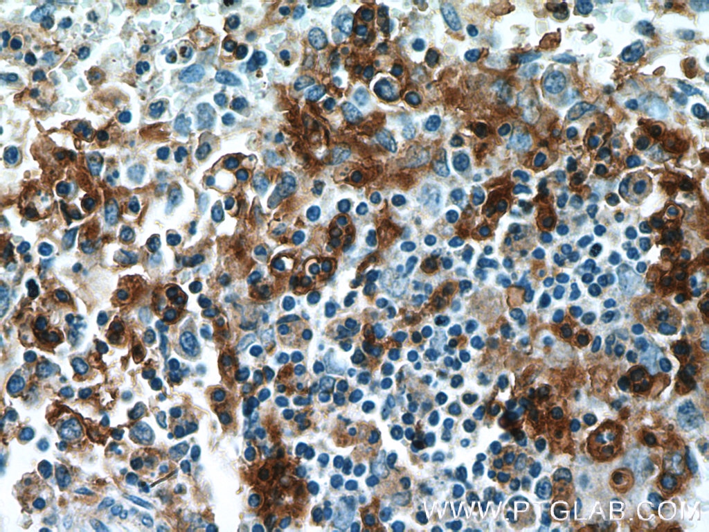 IHC staining of human spleen using 17342-1-AP