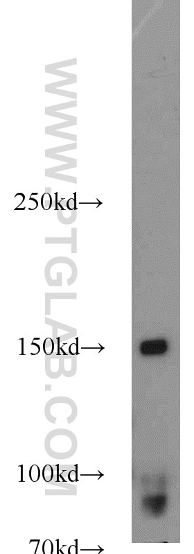 Western Blot (WB) analysis of human plasma using CD11c/Integrin Alpha X Polyclonal antibody (17342-1-AP)