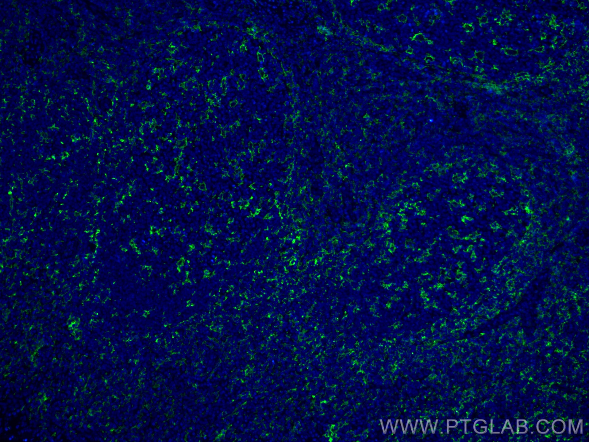 Immunofluorescence (IF) / fluorescent staining of human tonsillitis tissue using CD11c/Integrin Alpha X Monoclonal antibody (60258-1-Ig)