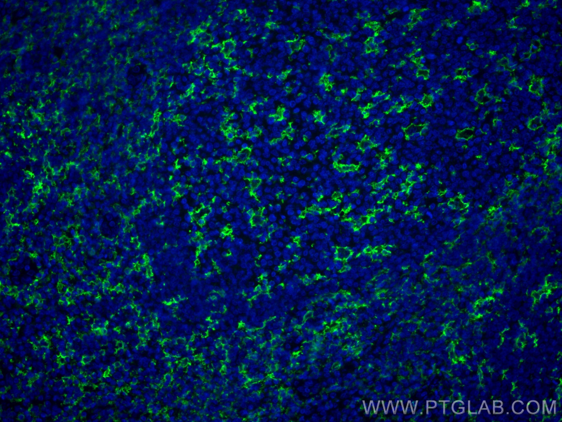 Immunofluorescence (IF) / fluorescent staining of human tonsillitis tissue using CD11c/Integrin Alpha X Monoclonal antibody (60258-1-Ig)