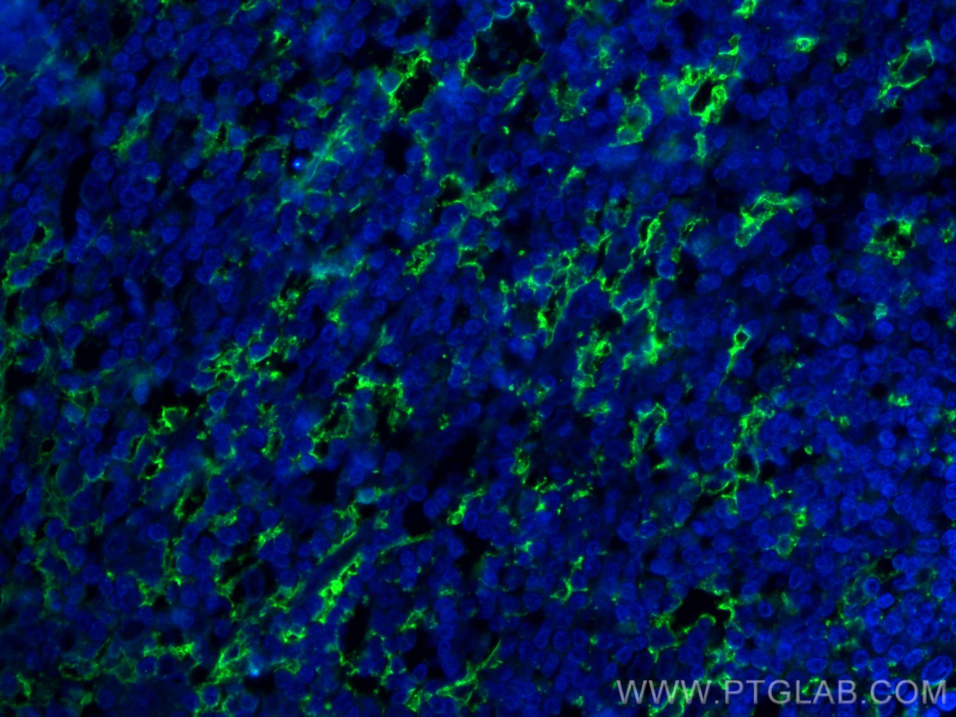 Immunofluorescence (IF) / fluorescent staining of human appendicitis tissue using CD11c/Integrin Alpha X Monoclonal antibody (60258-1-Ig)
