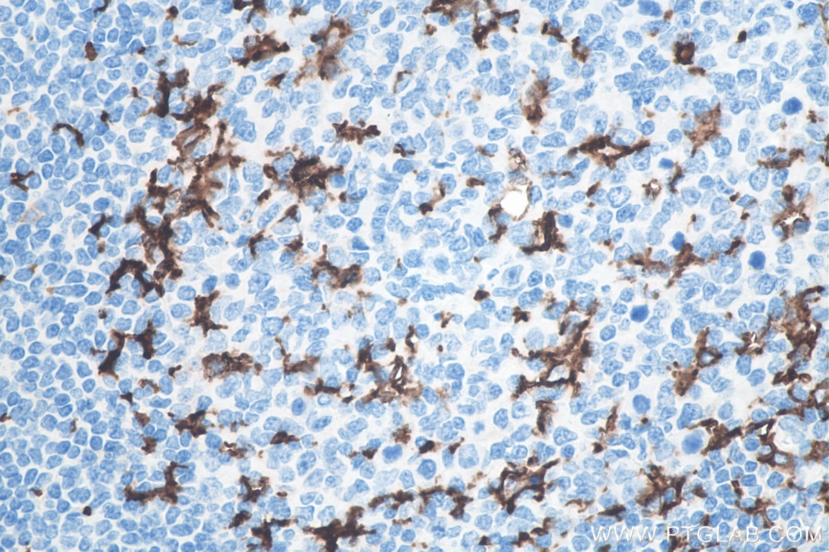 Immunohistochemistry (IHC) staining of human tonsillitis tissue using CD11c/Integrin Alpha X Monoclonal antibody (60258-1-Ig)