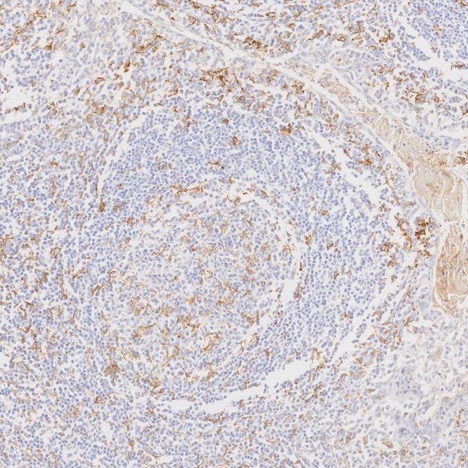 Immunohistochemistry (IHC) staining of human tonsillitis tissue using CD11c Monoclonal antibody (60258-1-Ig)