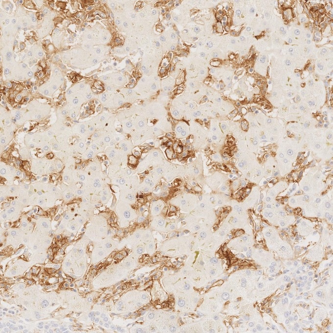 Immunohistochemistry (IHC) staining of human liver tissue using CD11c Monoclonal antibody (60258-1-Ig)