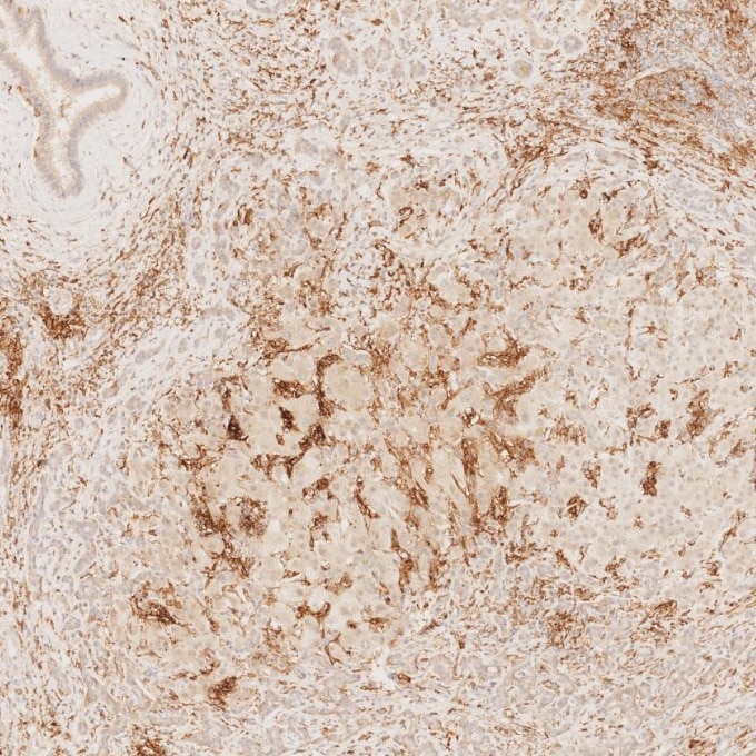 Immunohistochemistry (IHC) staining of human liver tissue using CD11c Monoclonal antibody (60258-1-Ig)