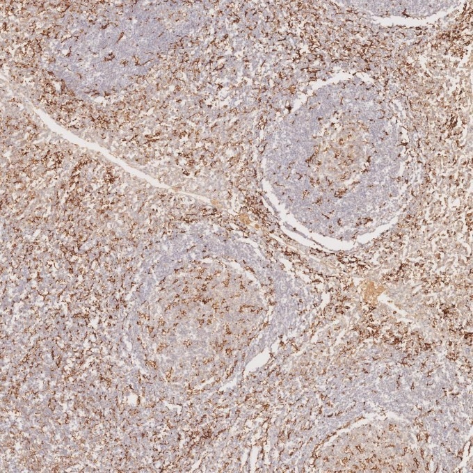 Immunohistochemistry (IHC) staining of human tonsillitis tissue using CD11c Monoclonal antibody (60258-1-Ig)