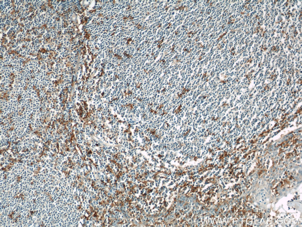 CD11c/Integrin Alpha X Monoclonal antibody