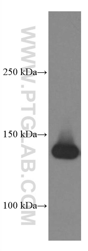 Western Blot (WB) analysis of THP-1 cells using CD11c/Integrin Alpha X Monoclonal antibody (60258-1-Ig)