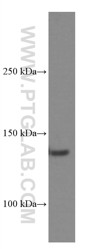 Western Blot (WB) analysis of HL-60 cells using CD11c/Integrin Alpha X Monoclonal antibody (60258-1-Ig)