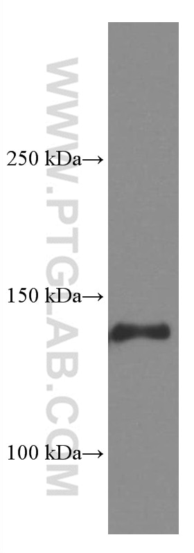 Western Blot (WB) analysis of U-937 cells using CD11c/Integrin Alpha X Monoclonal antibody (60258-1-Ig)