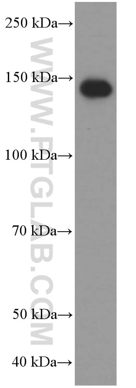 Western Blot (WB) analysis of human spleen tissue using CD11c/Integrin Alpha X Monoclonal antibody (60258-1-Ig)