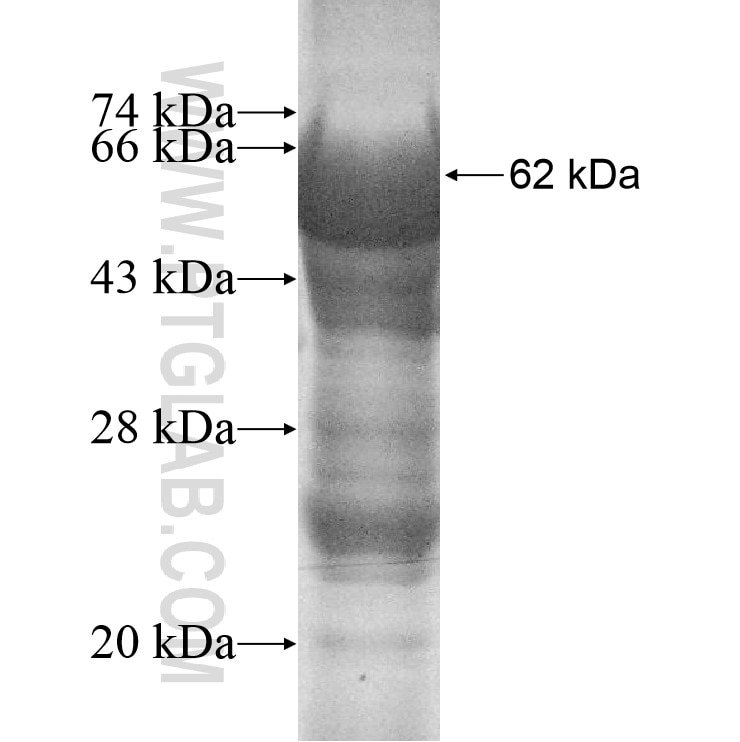 CD11c/Integrin alpha X fusion protein Ag11380 SDS-PAGE