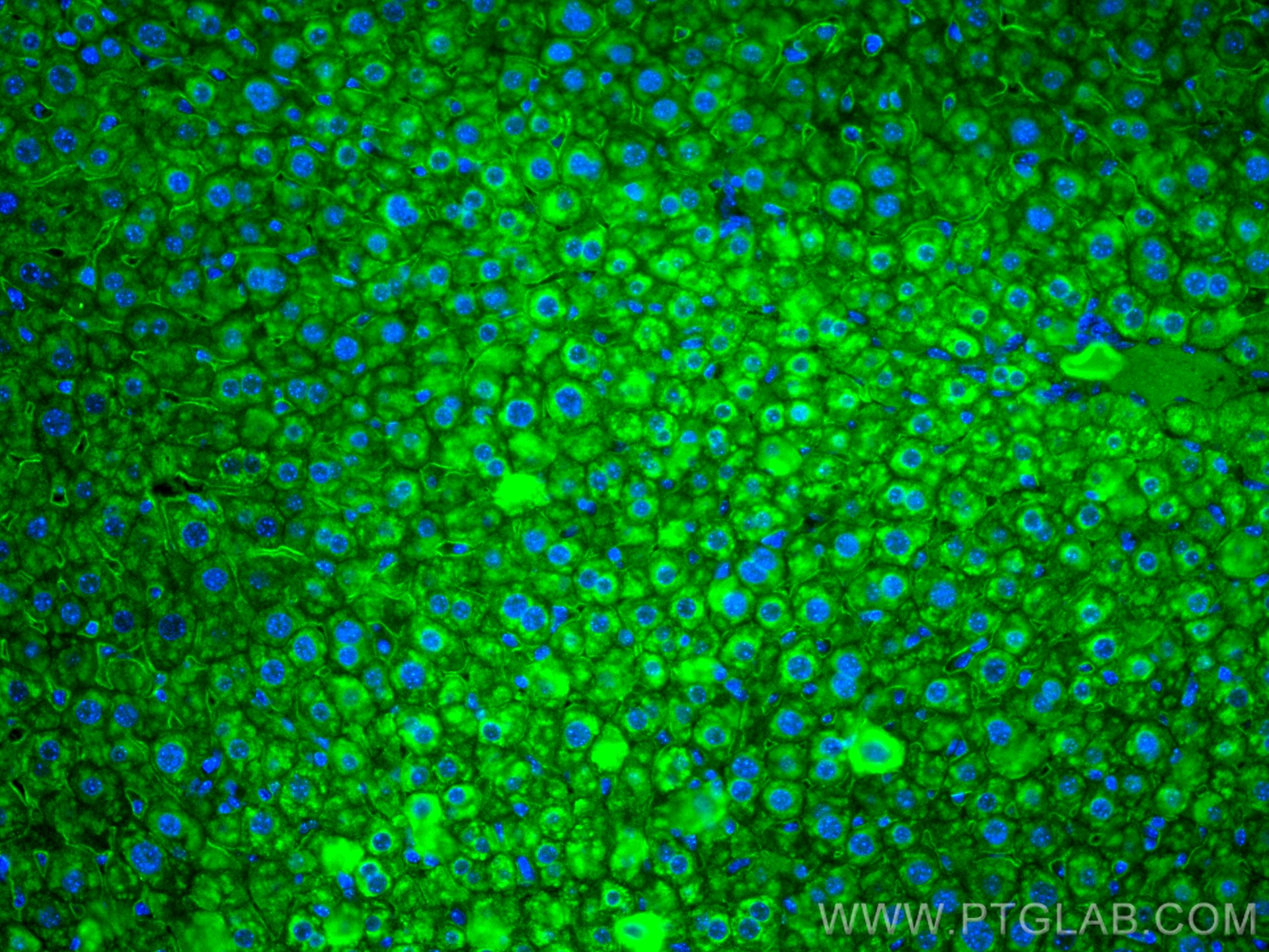 Immunofluorescence (IF) / fluorescent staining of mouse liver tissue using Integrin Beta 1 Polyclonal antibody (12594-1-AP)