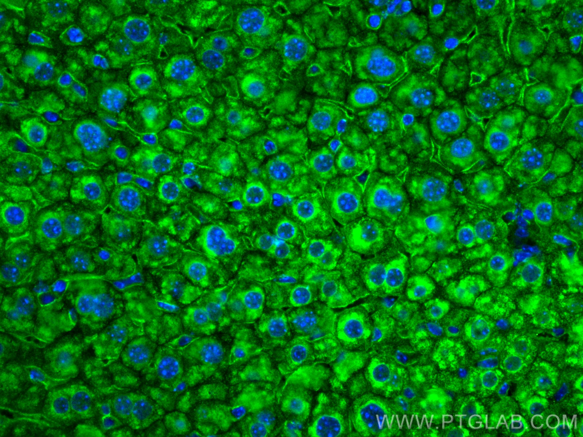 Immunofluorescence (IF) / fluorescent staining of mouse liver tissue using Integrin Beta 1 Polyclonal antibody (12594-1-AP)