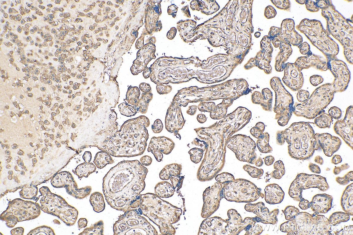 Immunohistochemistry (IHC) staining of human placenta tissue using Integrin Beta 1 Polyclonal antibody (12594-1-AP)