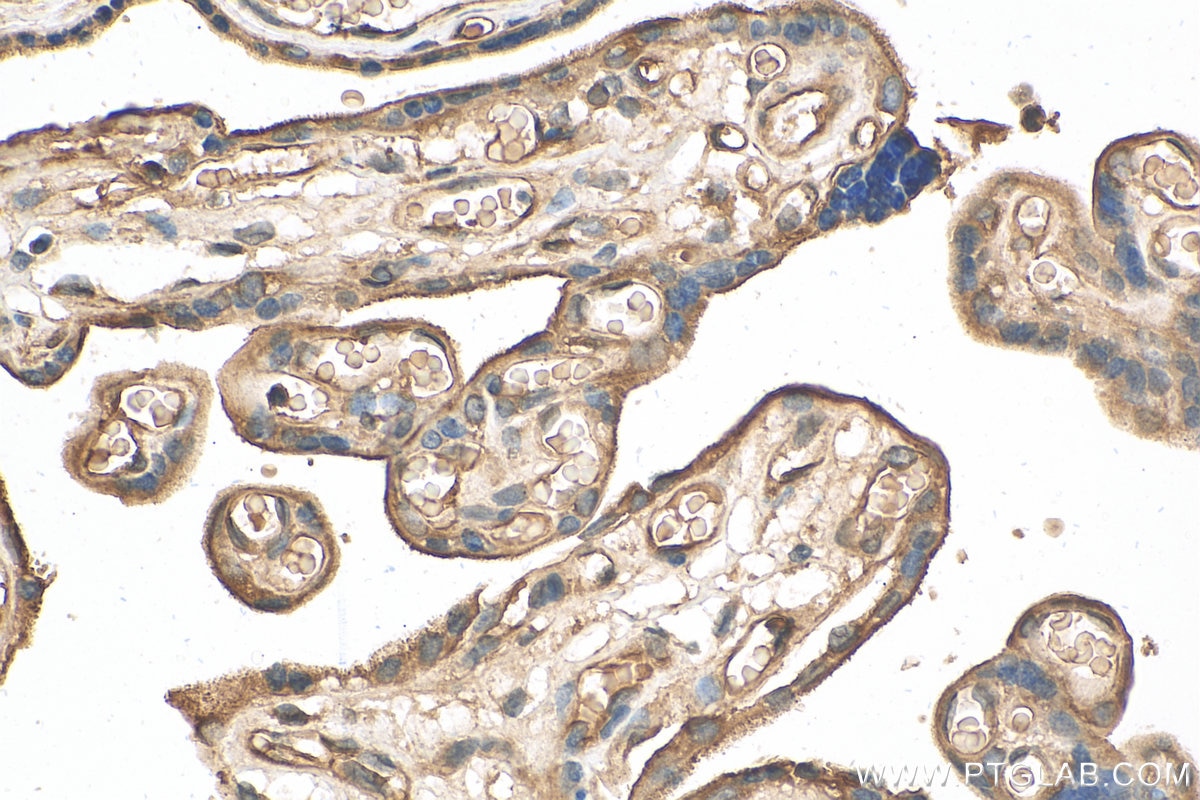 Immunohistochemistry (IHC) staining of human placenta tissue using Integrin Beta 1 Polyclonal antibody (12594-1-AP)