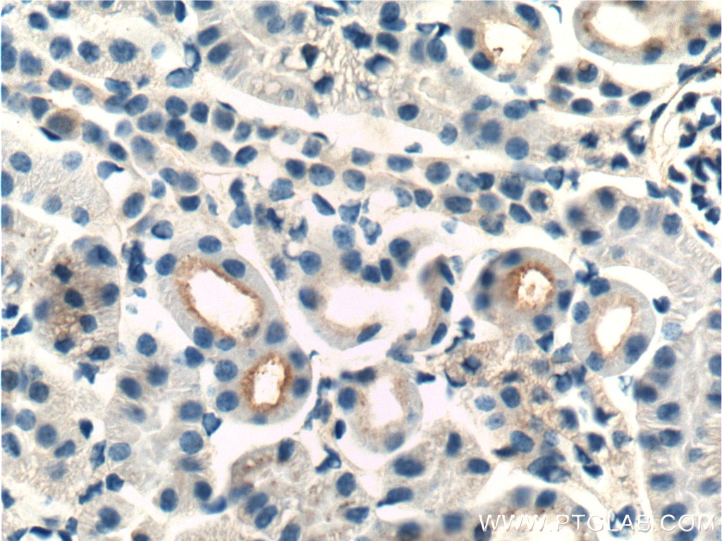 Immunohistochemistry (IHC) staining of mouse kidney tissue using Integrin Beta 1 Polyclonal antibody (12594-1-AP)