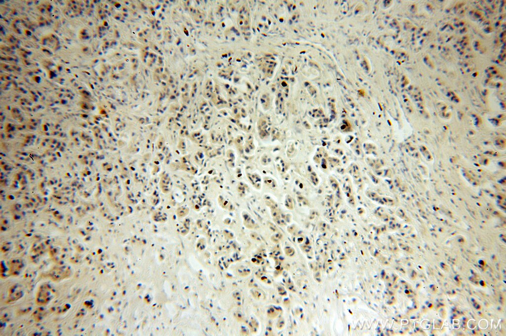 Integrin Beta 1