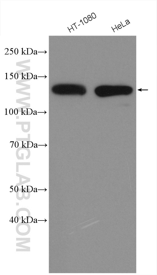 Western Blot (WB) analysis of various lysates using Integrin Beta 1 Polyclonal antibody (12594-1-AP)