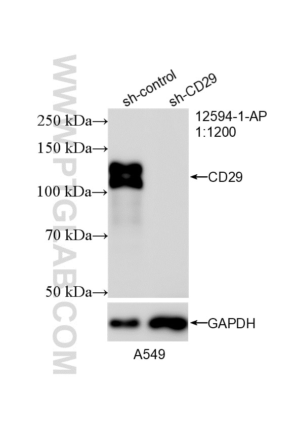 Western Blot (WB) analysis of A549 cells using Integrin Beta 1/CD29 Polyclonal antibody (12594-1-AP)
